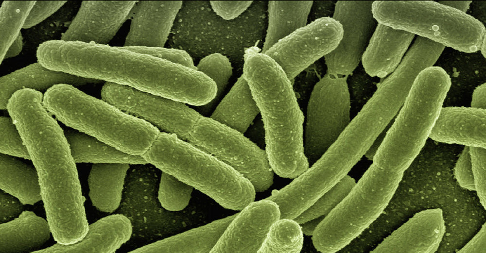 Escherichia coli (E. coli)